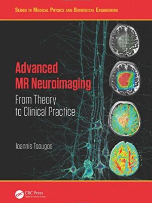 Advanced MR Neuroimaging: From Theory to Clinical Practice – Ioannis Tsougos – eBook