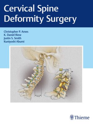 Cervical Spine Deformity Surgery – eBook PDF
